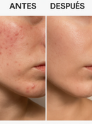 COMPRA 1 Y LLEVA 2 - 345 DR ALTHEA RELIEF