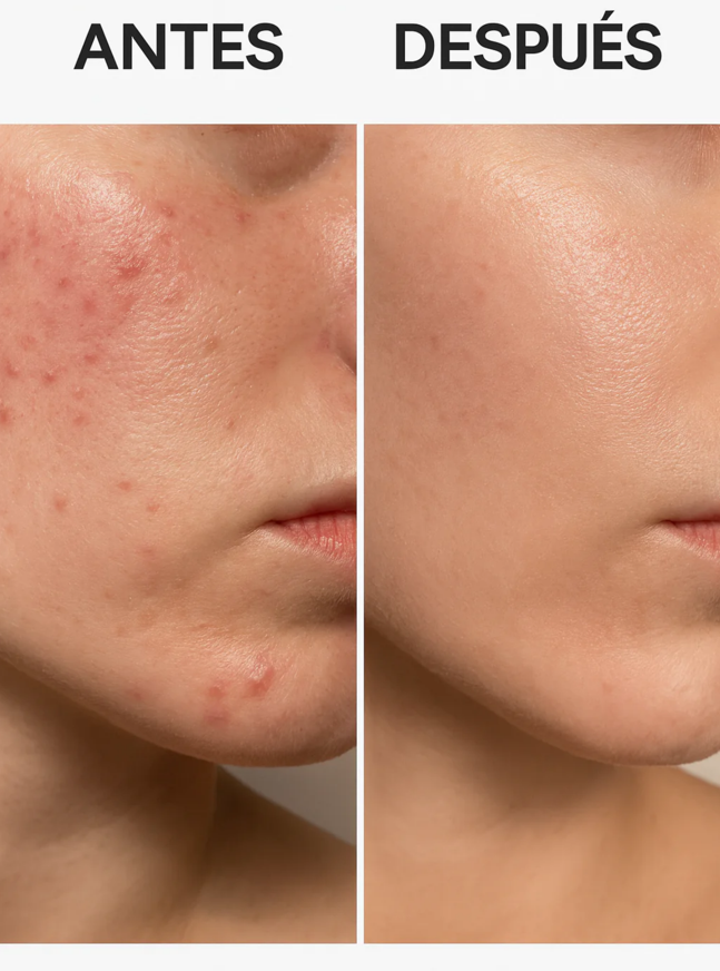 COMPRA 1 Y LLEVA 2 - 345 DR ALTHEA RELIEF